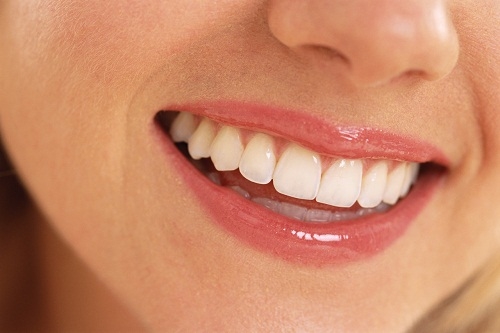 Restauração de Dentes - Dentística
