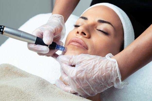 Estética integrativa, microagulhamento e Butoline