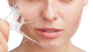 Peeling